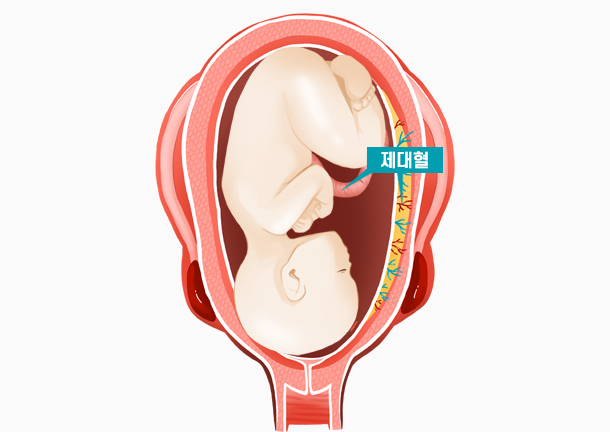 제대혈 조혈모세포란 무엇일까?
